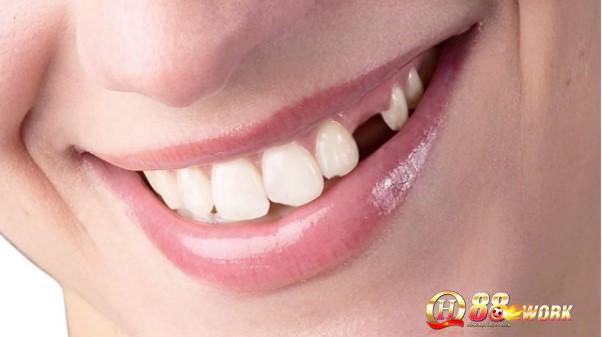 Nằm mơ thấy rụng răng có thể là dấu hiệu của 1 tâm trạng bất an